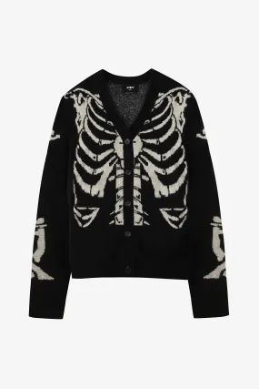 Skeleton Knit Cardigan | Black